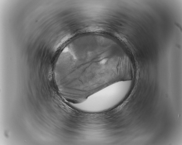 X0000099291306200805301103