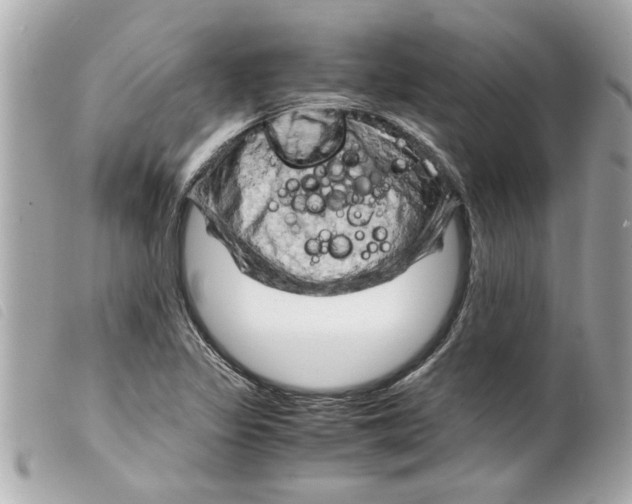 X0000099291317200805301103