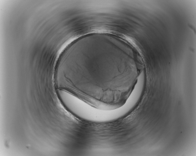 X0000099291331200805301103