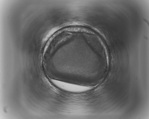 X0000099291367200805301102