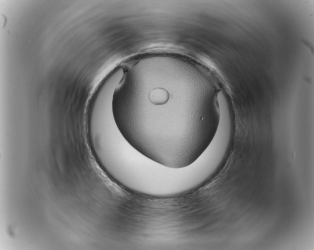 X0000099291376200805301102