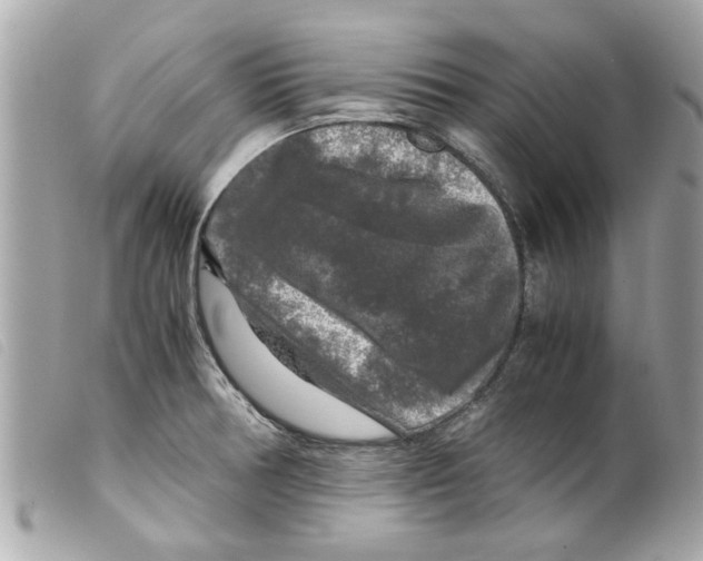 X0000099291378200805301102