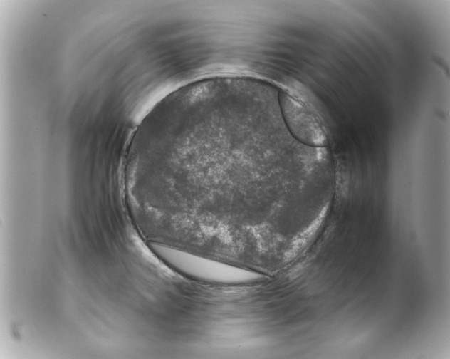 X0000099291382200805301102