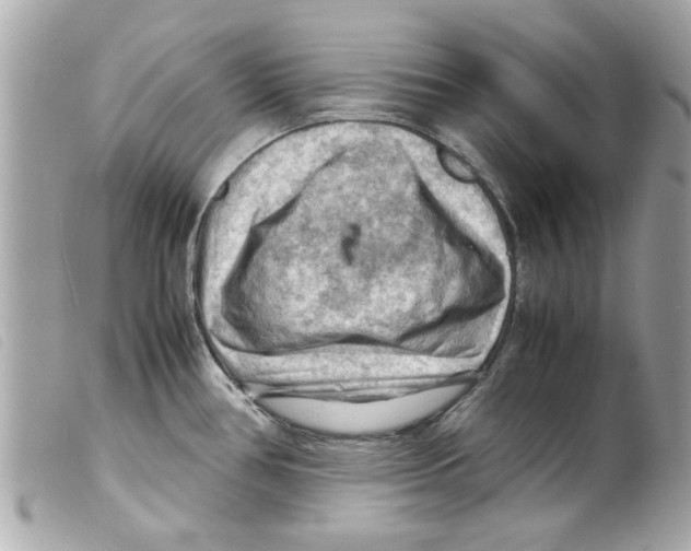 X0000099291386200805301102