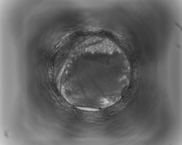 X0000099291397200805301101