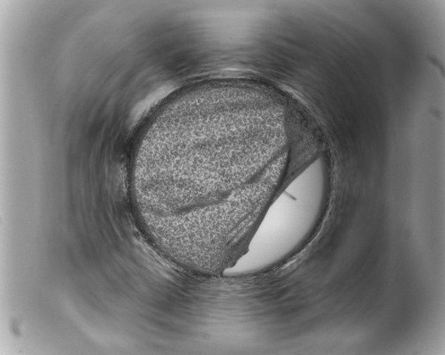 X0000099291402200805301101