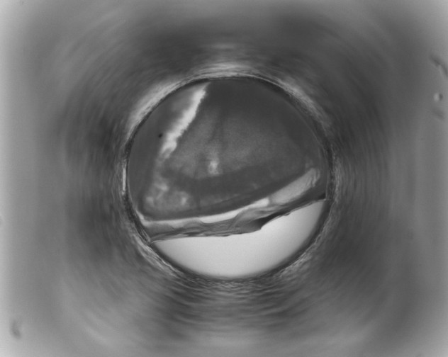 X0000099291413200805301102