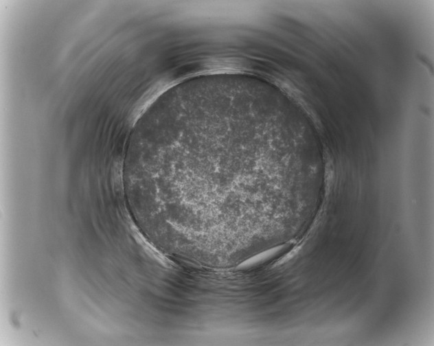 X0000099291417200805301102