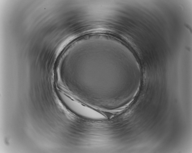 X0000099291418200805301102