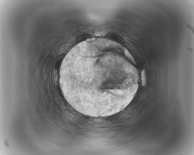 X0000099291443200805301101