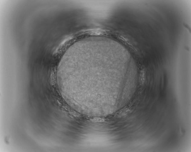 X0000099291446200805301101