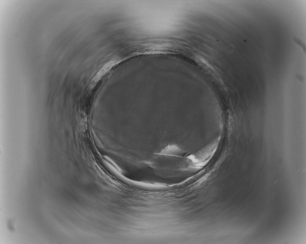 X0000099291449200805301101