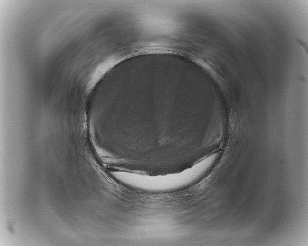 X0000099291461200805301101