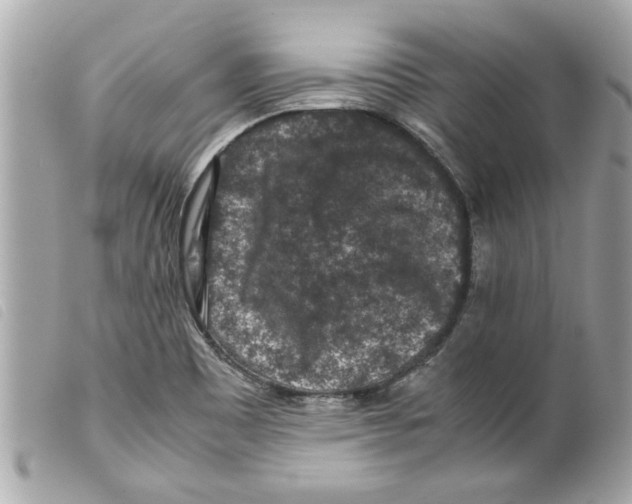 X0000099291465200805301101