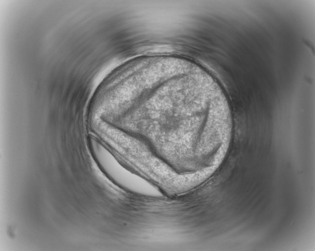 X0000099291475200805301101