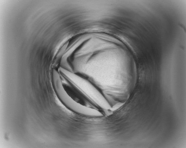 X0000099291476200805301101