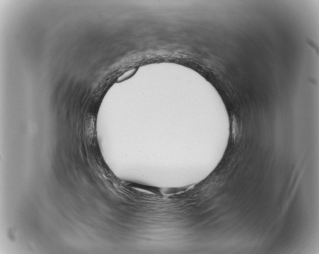 X0000099291492200805301100