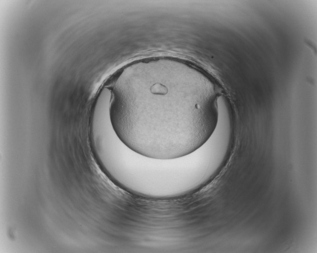 X0000099291500200805301100