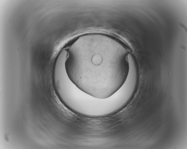 X0000099291504200805301100