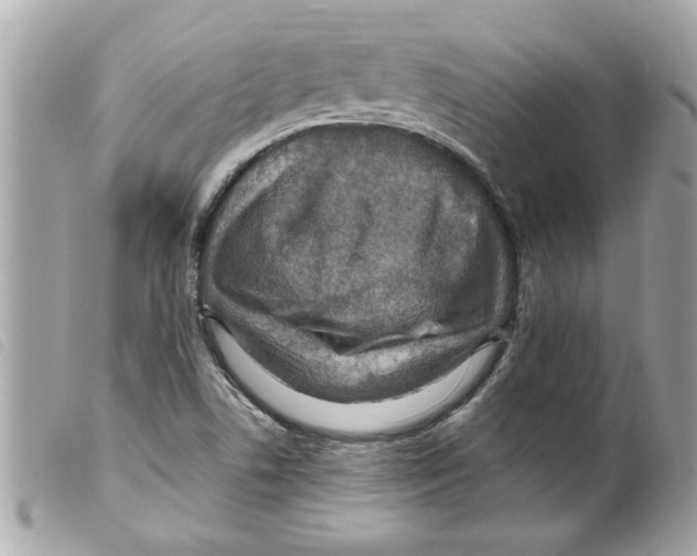 X0000099291506200805301100