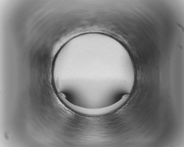 X0000099291512200805301100