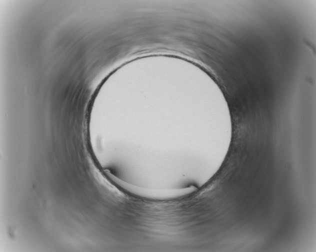 X0000099291518200805301101