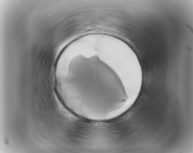 X0000099291522200805301101