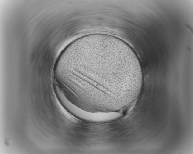 X0000099291523200805301101