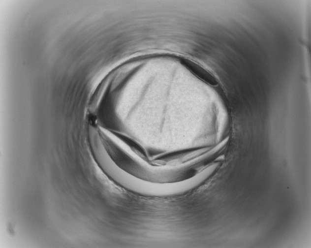 X0000099291524200805301101