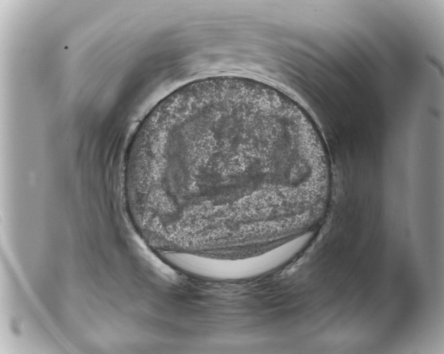 X0000099291525200805301101