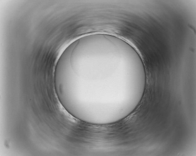 X0000099291532200805301101