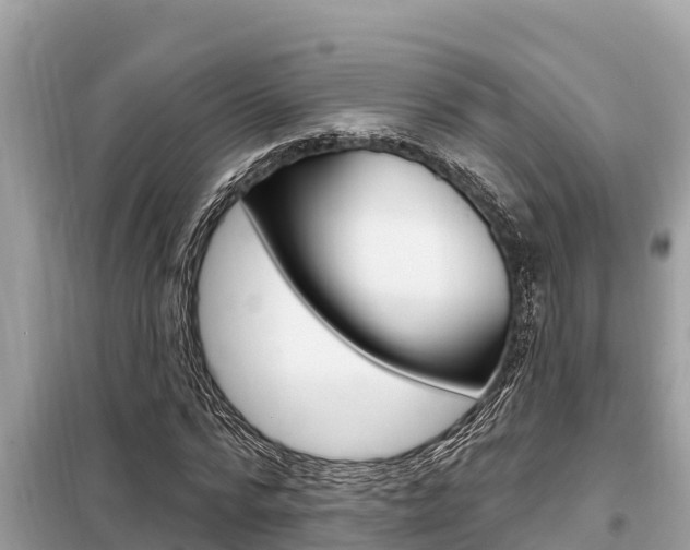 X0000099300776200805020756