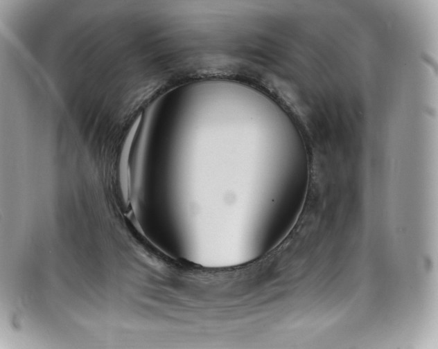 X0000099300017200805021241