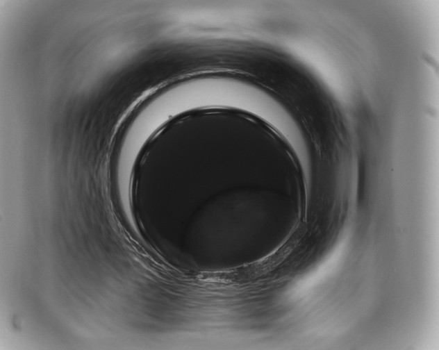 X0000099300387200805021236