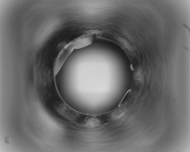 X0000099300572200805021233