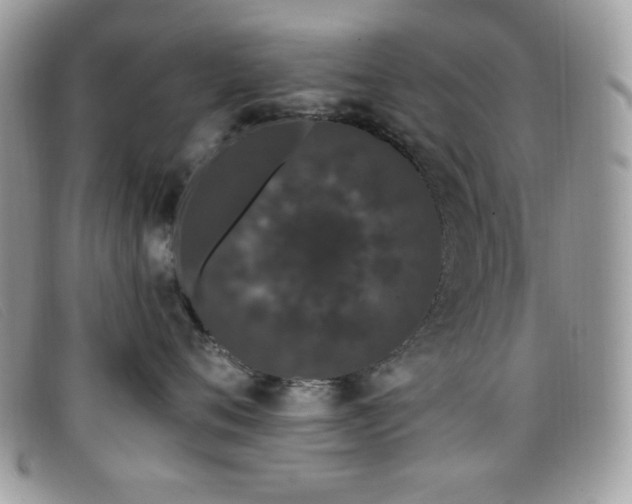 X0000099300720200805021231