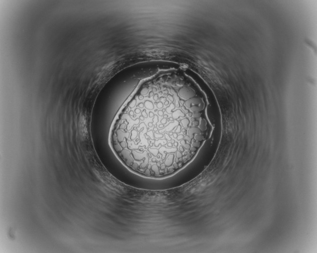 X0000099301106200805021225