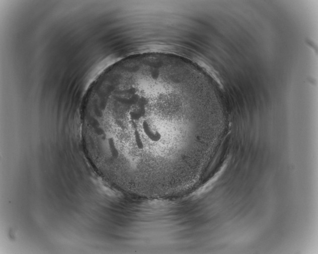 X0000099301117200805021225