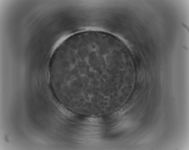 X0000099301271200805021223