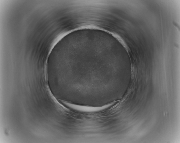 X0000099301295200805021223