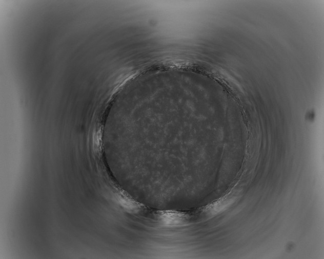 X0000099300336200805091000