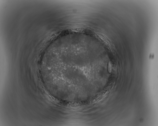 X0000099300817200805090952