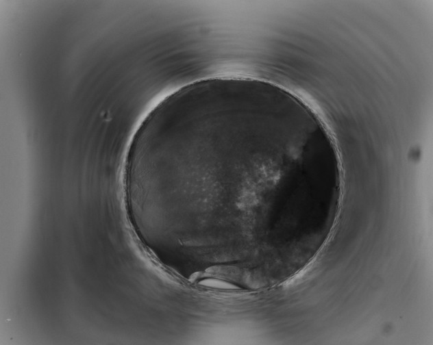 X0000099300864200805090953