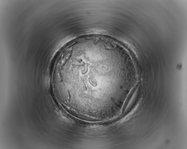 X0000099301117200805090948