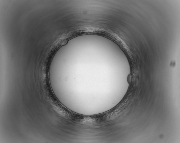 X0000099300257200805161355