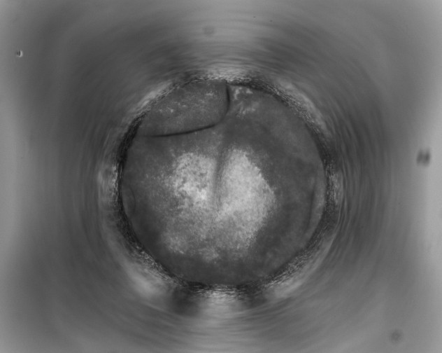 X0000099300308200805161355