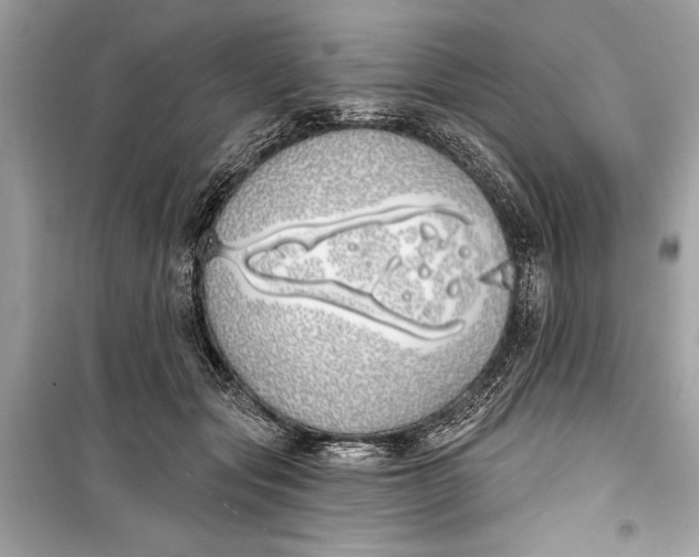 X0000099300557200805161351