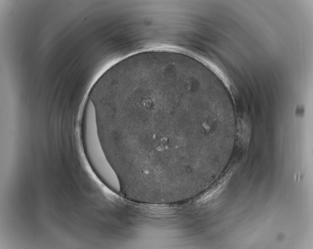 X0000099301007200805161344