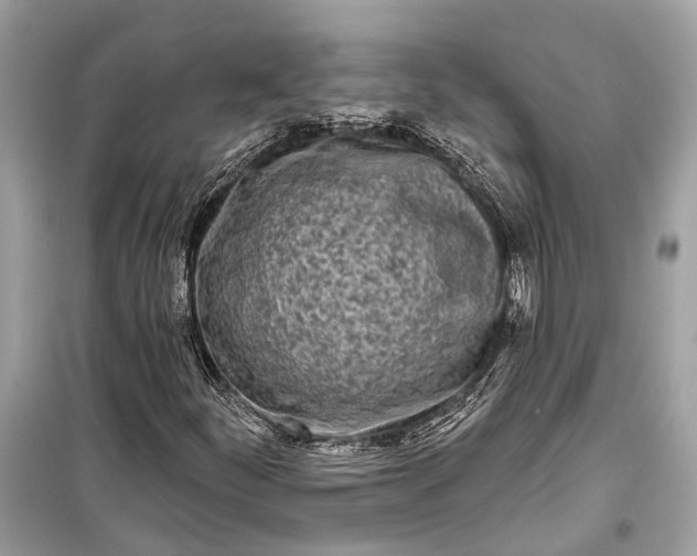 X0000099301252200805161340