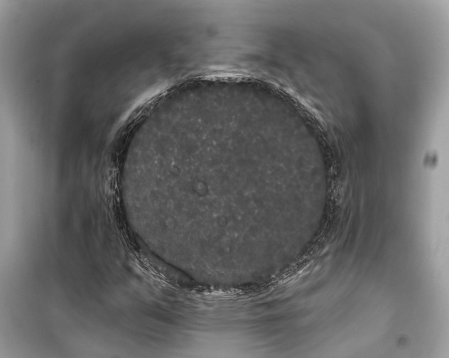 X0000099301351200805161339